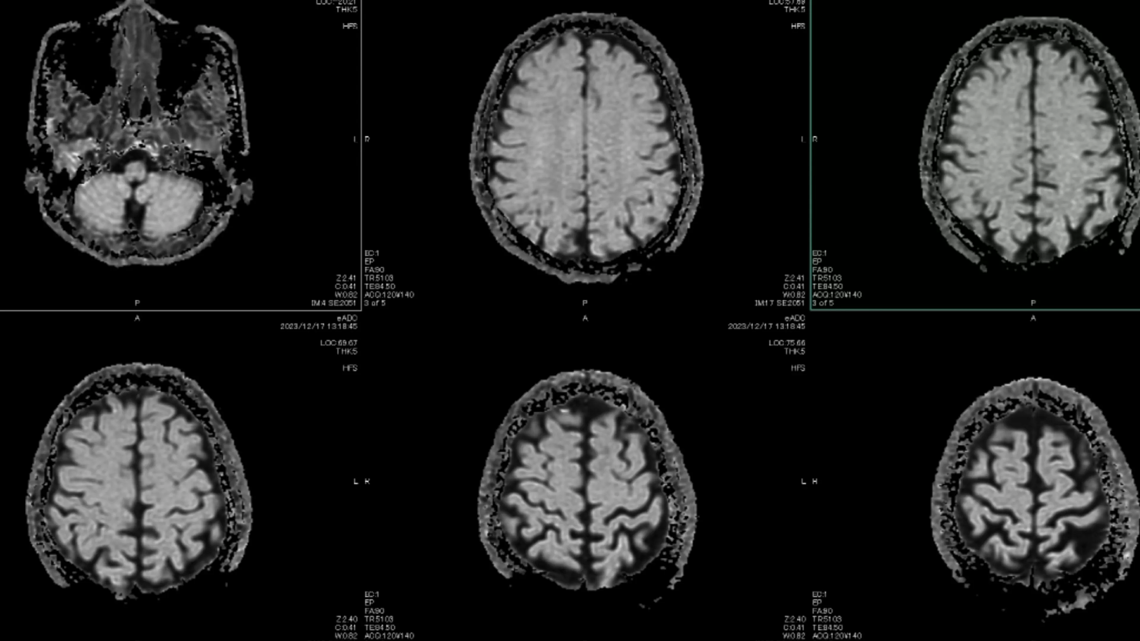 Healthcare Is AI’s Hardest Test
