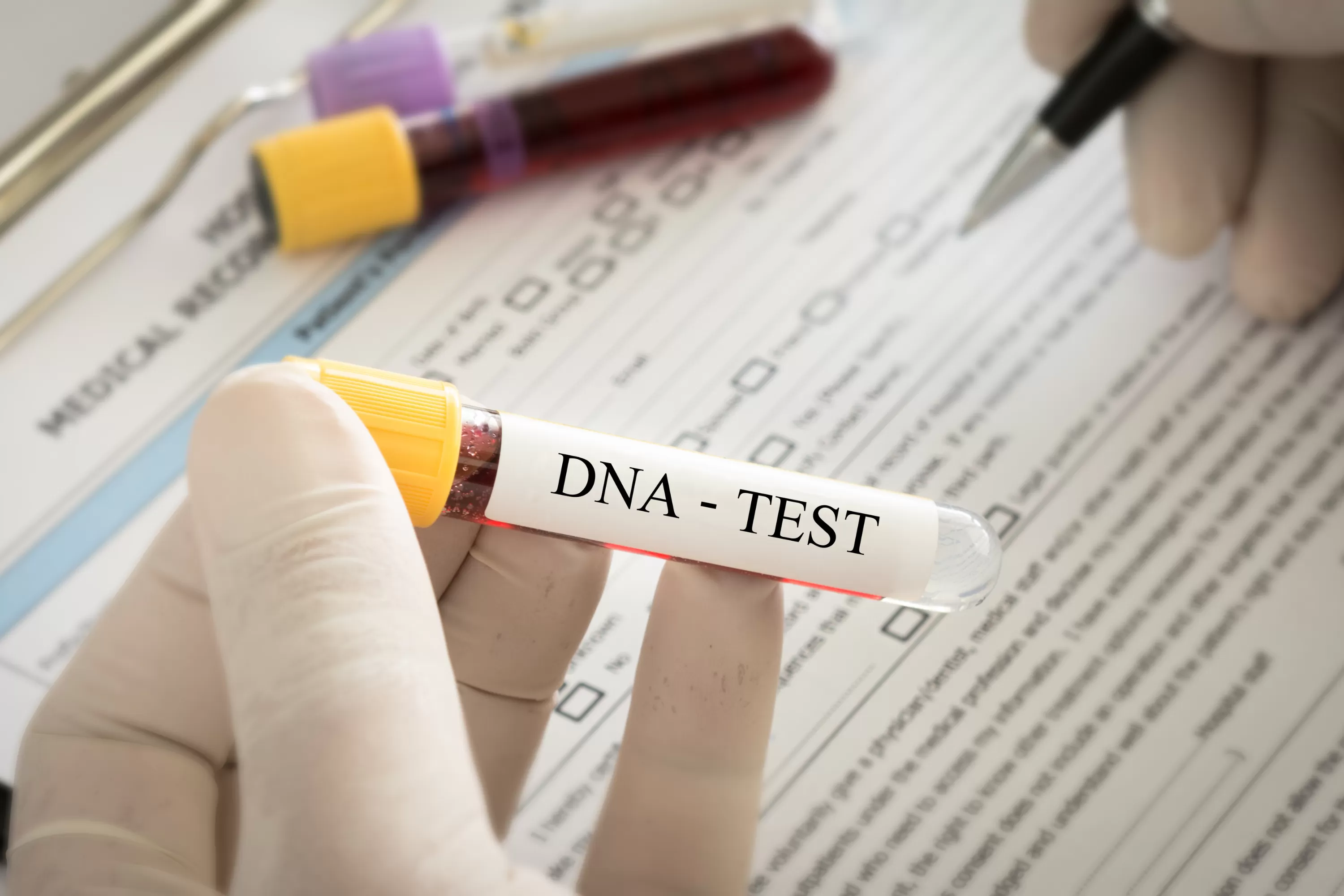 People Think Dog Is Part-Coyote—Then DNA Test Reveals Truth  