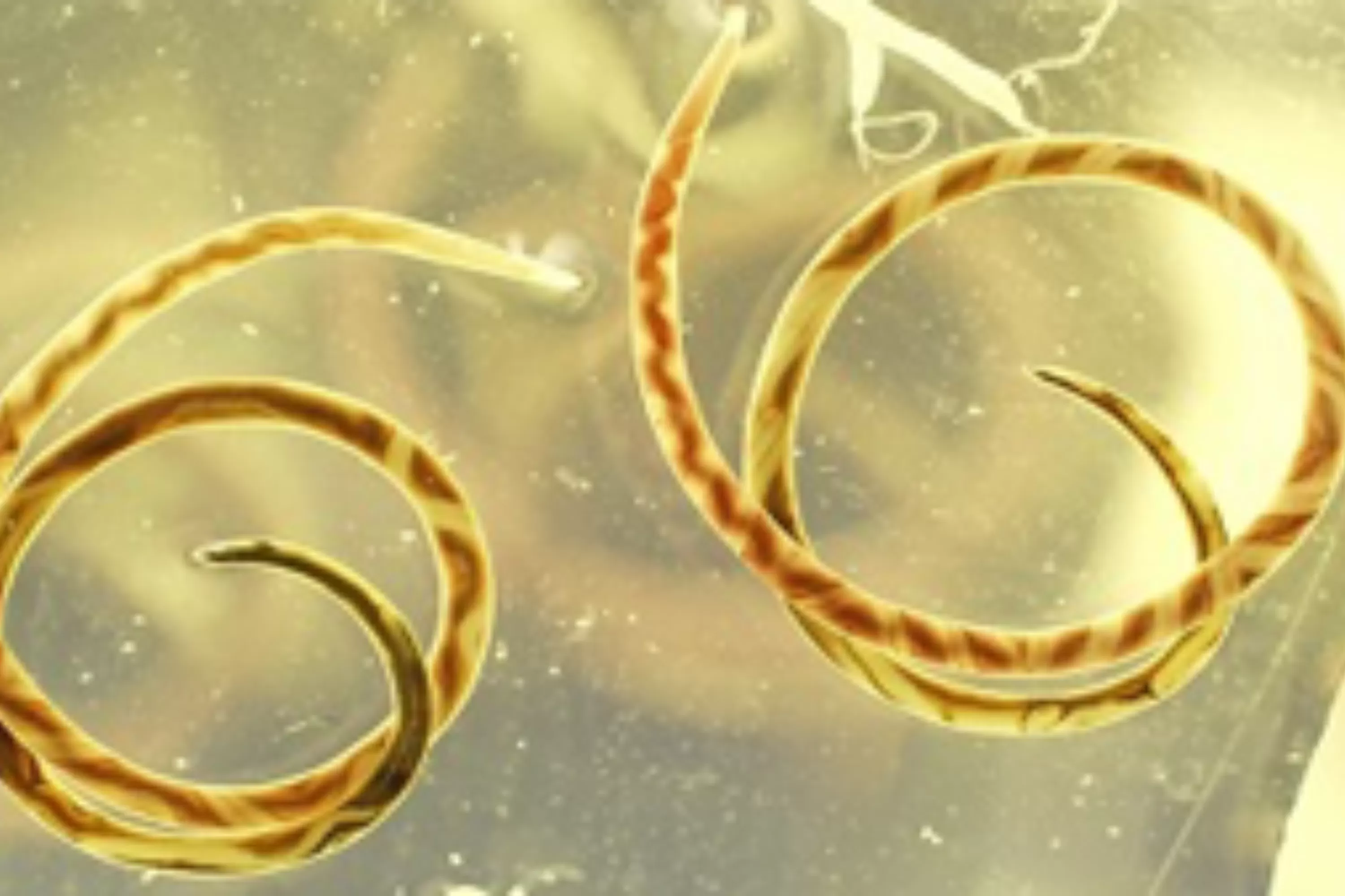 Rat Lungworm Is in California—How Does it Affect Humans?